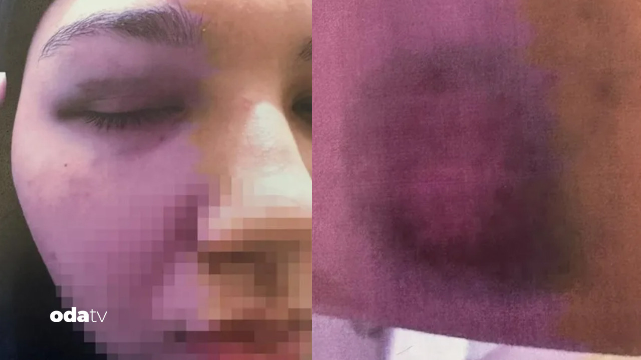 Beyoğlu’nda anne-kıza bitmeyen şiddet: Hem cinsel hem fiziki