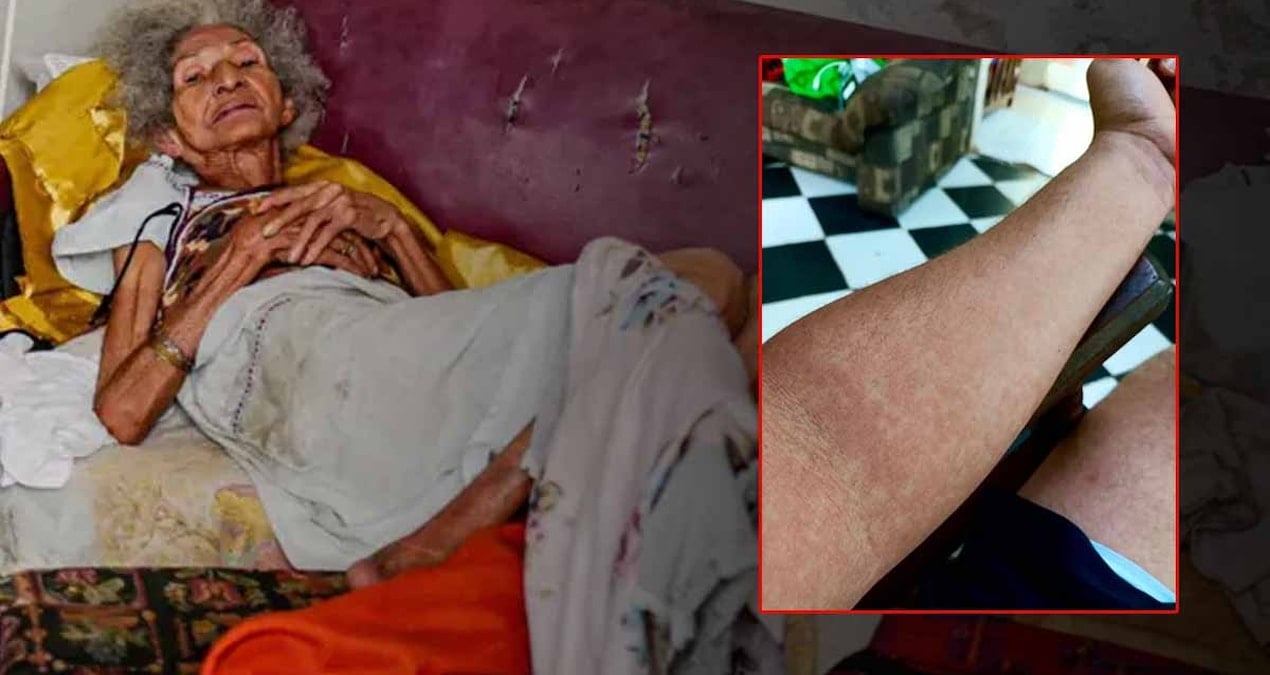 Birdenbire yaşlanıyorlar, virüs ülke halkını zombiye çevirdi! Sokaklar yürüyemeyen insanlarla dolu